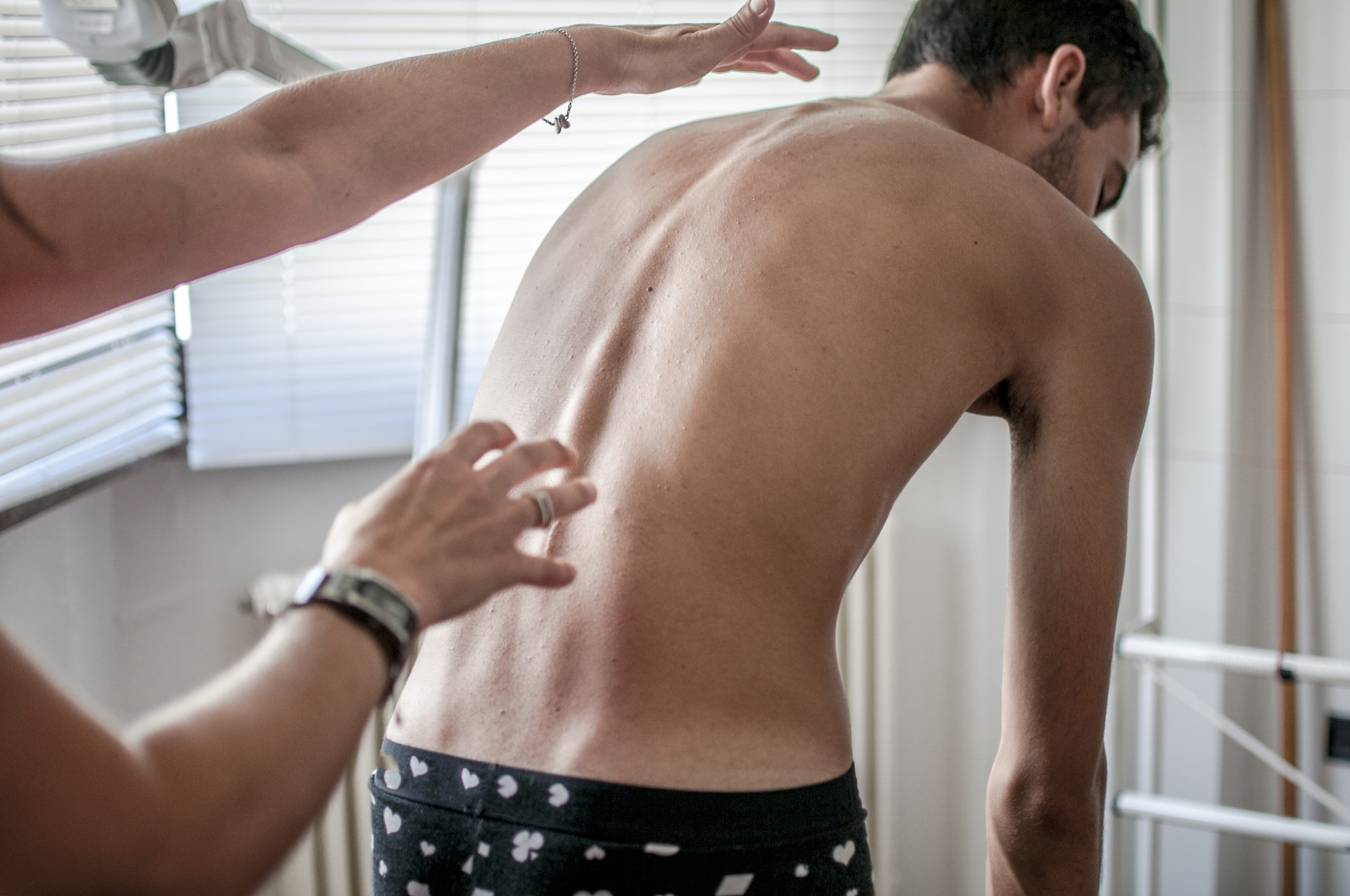A physiotherapist check body growth of young man